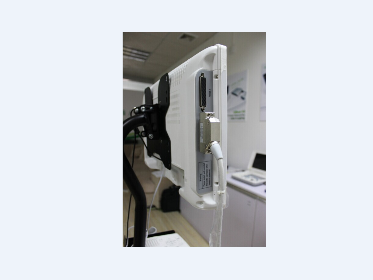 Syringe 2ml, luer slip 3 - Image 3