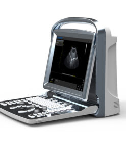 Alternative view of portable oxygen concentrator for travel