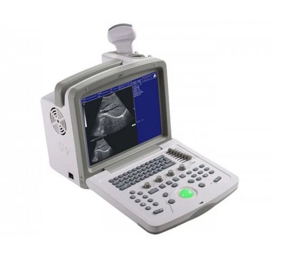 Ultrasound Scanner WED-180