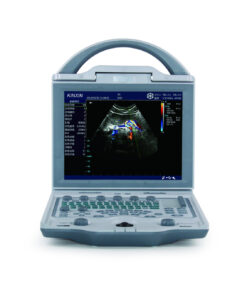Alternative view of Portable Color Doppler Ultrasound DCU-12