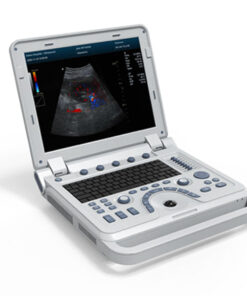 CMS600P2Plus B Ultrasound ��� Portable with Abdomen Convex Probe