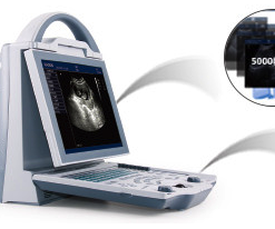Alternative view of KX5600 Human Diagnostic Ultrasound