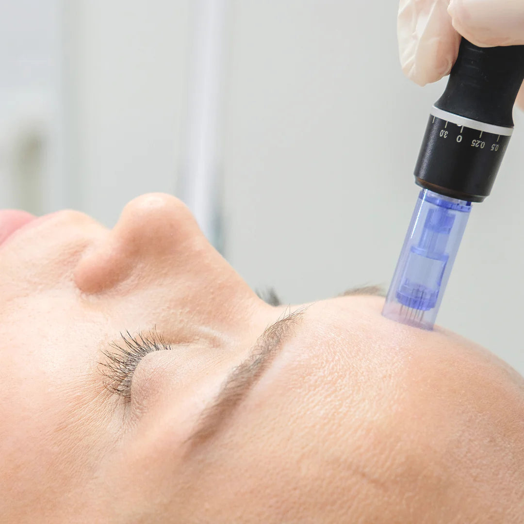 Purl��s Derma Solution Online Course (Microneedling)