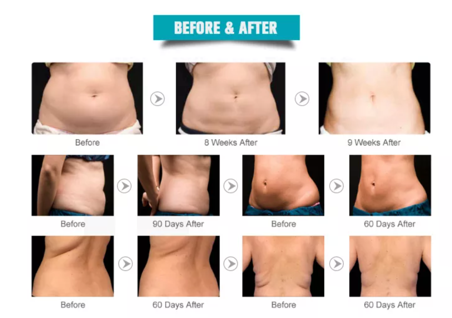 6 in 1 Slimming Lipolaser Cavitation Machine - Image 7